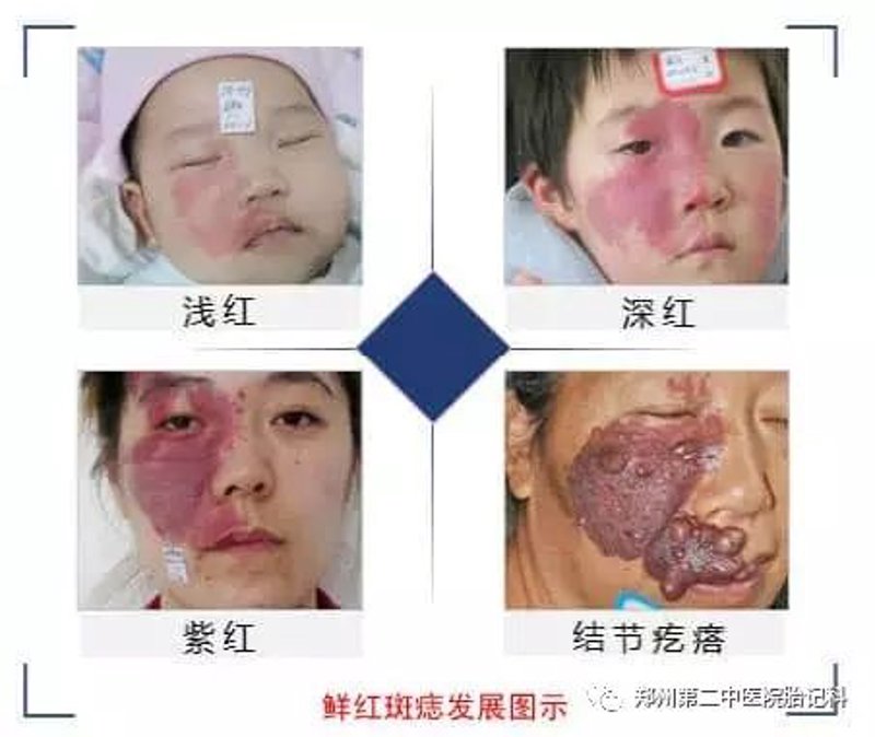 广州健肤皮肤专科门诊部:守护肌肤健康的新选择