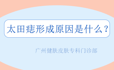 广州正规胎记医院排名，太田痣的最佳治疗时间是什么时候？
