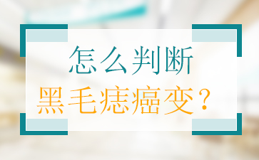广州正规胎记医院排名，黑毛痣的形成原因有哪些？